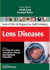 Lens Diseases