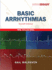 Basic Arrhythmias