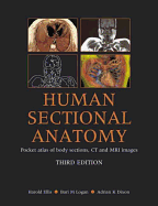 Human Sectional Anatomy: Pocket Atlas of Body Sections, CT and MRI Images