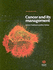 Cancer and Its Management Fourth Edition