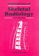 Fundamentals of Skeletal Radiology