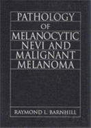 Pathology of Melanocytic Nevi and Malignant Melanoma