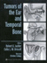 Tumors of the Ear and Temporal Bone
