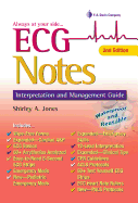 ECG Notes: Interpretation and Management Guide