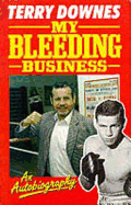My bleeding business.