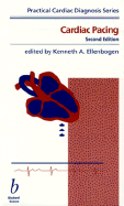 Cardiac pacing
