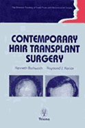 The intelligent man's guide to hair transplants and other methods of hair replacement Walter P. Unger