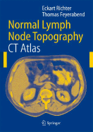 Normal Lymph Node Topography: CT-Atlas