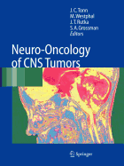 Neuro-Oncology of CNS Tumors