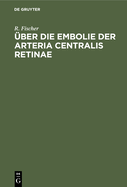 ber Die Embolie Der Arteria Centralis Retinae