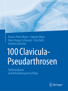 100 Clavicula-Pseudarthrosen: Fehleranalysen Und Behandlungsvorschlage