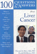 100 Q&a About Liver Cancer (100 Questions and Answers About...)