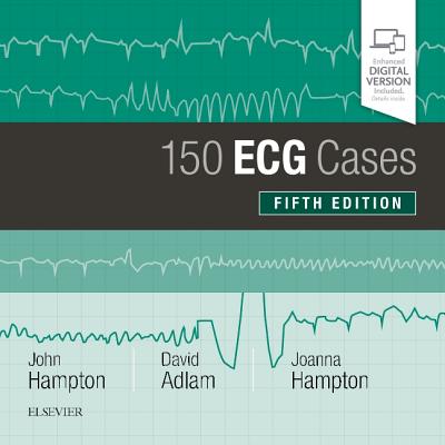 150 ECG Cases - Hampton, John, DM, Ma, Dphil, Frcp, and Adlam, David, Ba, Bm, Bch, Dphil, Frcp, and Hampton, Joanna, MD, Ma, Bm, Bch, Frcp