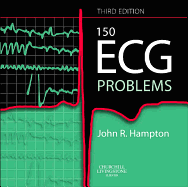 150 ECG Problems