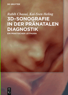 3d-Sonografie in Der Pr?natalen Diagnostik