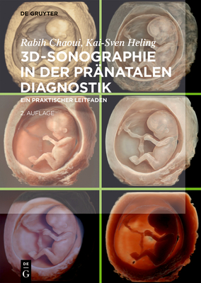 3d-Sonographie in Der Pr?natalen Diagnostik: Ein Praktischer Leitfaden - Chaoui, Rabih, and Heling, Kai-Sven