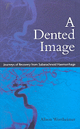 A Dented Image: Journeys of Recovery from Subarachnoid Haemorrhage