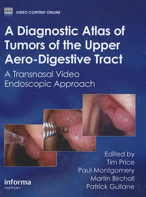 A Diagnostic Atlas of Tumors of the Upper Aero-Digestive Tract: A Transnasal Video Endoscopic Approach - Price, Tim (Editor), and Montgomery, Paul (Editor), and Birchall, Martin (Editor)