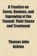 A Treatise on Corns, Bunions, and Ingrowing of the Toenail: Their Cause and Treatment