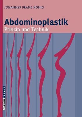 Abdominoplastik: Prinzip Und Technik - Hnig, Johannes-Franz