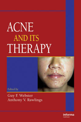 Acne and Its Therapy - Webster, Guy F (Editor), and Rawlings, Anthony V (Editor)