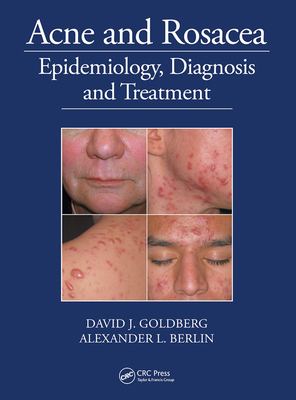 Acne and Rosacea: Epidemiology, Diagnosis and Treatment - Goldberg, David, and Berlin, Alexander