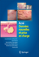 Acne: Donnees Nouvelles Et Prise En Charge