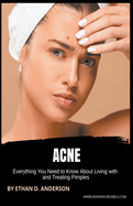 Acne: Everything You Need to Know About Living with and Treating Pimples