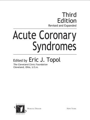 Acute Coronary Syndromes - Topol, Eric (Editor)