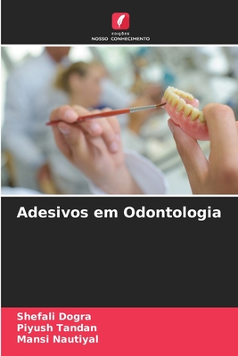 Adesivos em Odontologia - Dogra, Shefali, and Tandan, Piyush, and Nautiyal, Mansi