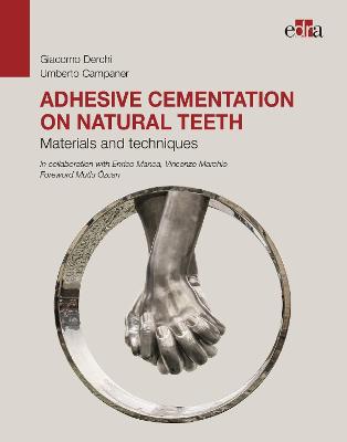 Adhesive cementation on natural teeth - Materials and techniques - Derchi, Giacomo, and Campaner, Umberto
