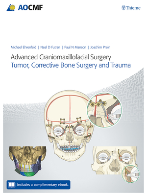 Advanced Craniomaxillofacial Surgery: Tumor, Corrective Bone Surgery, and Trauma - Ehrenfeld, Michael (Editor), and Futran, Neal D (Editor), and Manson, Paul (Editor)