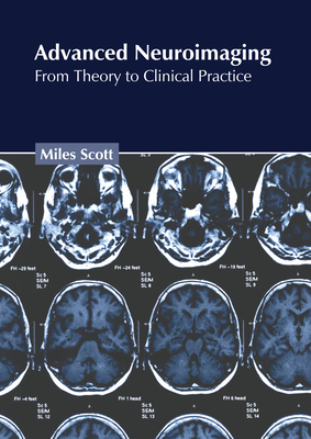 Advanced Neuroimaging: From Theory to Clinical Practice - Scott, Miles (Editor)