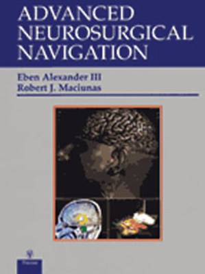 Advanced Neurosurgical Navigation - Alexander, Eben Jr (Editor), and Maciunas, Robert J (Editor)