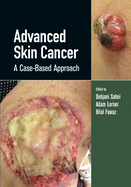 Advanced Skin Cancer: A Case-Based Approach