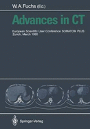 Advances in CT: European Scientific User Conference Somatom Plus Zurich, March 1990