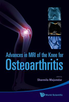 Advances In Mri Of The Knee For Osteoarthritis - Blumenfeld, Janet (Editor), and Majumdar, Sharmila (Editor), and Krug, Roland (Editor)