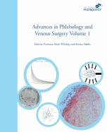 Advances in Phlebology and Venous Surgery - Volume 1