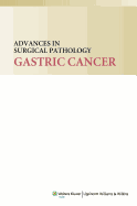Advances in Surgical Pathology: Gastric Cancer