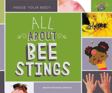 All about Bee Stings