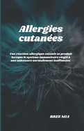 Allergies cutanes: Une raction allergique cutane se produit lorsque le systme immunitaire ragit  une substance normalement inoffensive.