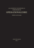 Allgemeiner Teil Und Die Operationen an Der Oberen Extremitat