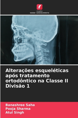 Altera??es esquel?ticas ap?s tratamento ortod?ntico na Classe II Divis?o 1 - Saha, Banashree, and Sharma, Pooja, and Singh, Atul