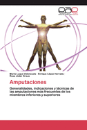 Amputaciones