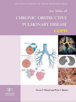 An Atlas of Chronic Obstructive Pulmonary Disease - Hansel, Trevor T, and Barnes, Peter J