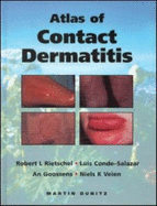 An Atlas of Contact Dermatitis - Conde-Salazar, Luis, and Goossens, An, and Rietschel, Robert L