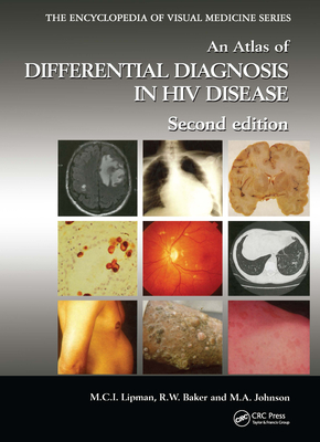 An Atlas of Differential Diagnosis in HIV Disease - Lipman, Marc C I, and Baker, Robert W, and Johnson, Margaret A