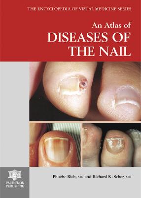 An Atlas of Diseases of the Nail - Rich, Phoebe, and Scher, Richard K