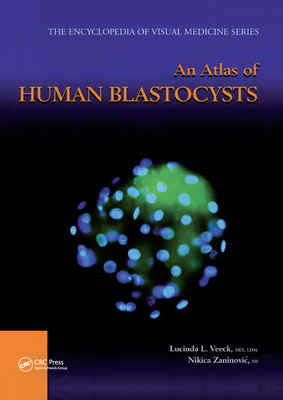 An Atlas of Human Blastocysts - Veeck, Lucinda L., and Zaninovic, Nikica
