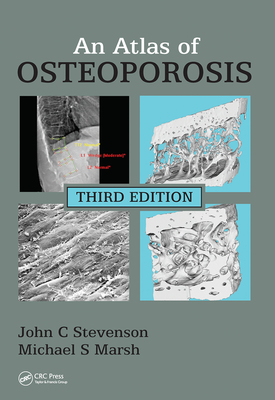An Atlas of Osteoporosis - Stevenson, John C, and Marsh, Michael S